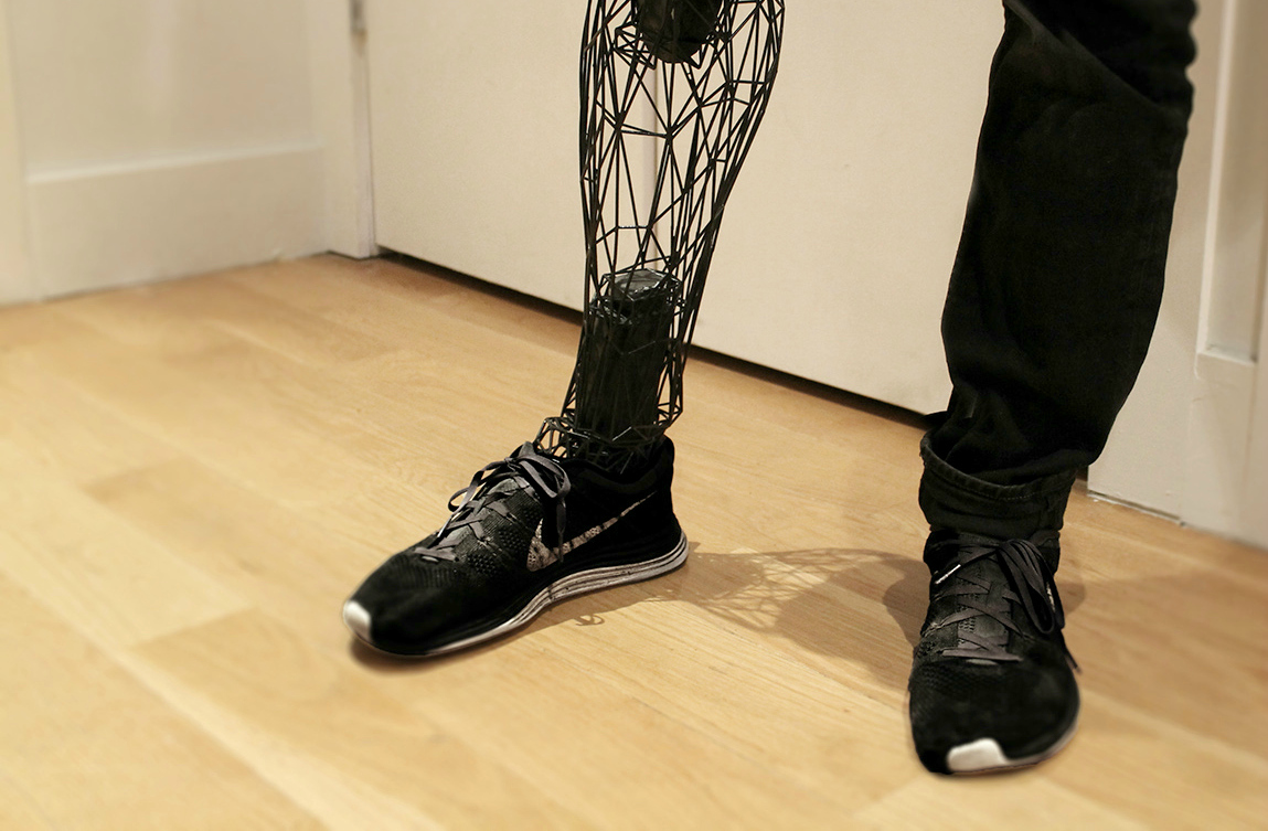 Проект Уилльяма Рута Exo Prosthetics решает проблемы протезирования, связанные с ценой, дискомфортом ношения и стрессом от неприятия новой конечности